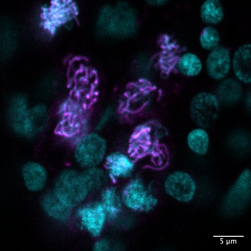 Image of a wild type Clytia hemisphaerica gonad, sycp1 antibody staining (magenta) and DNA (cyan)